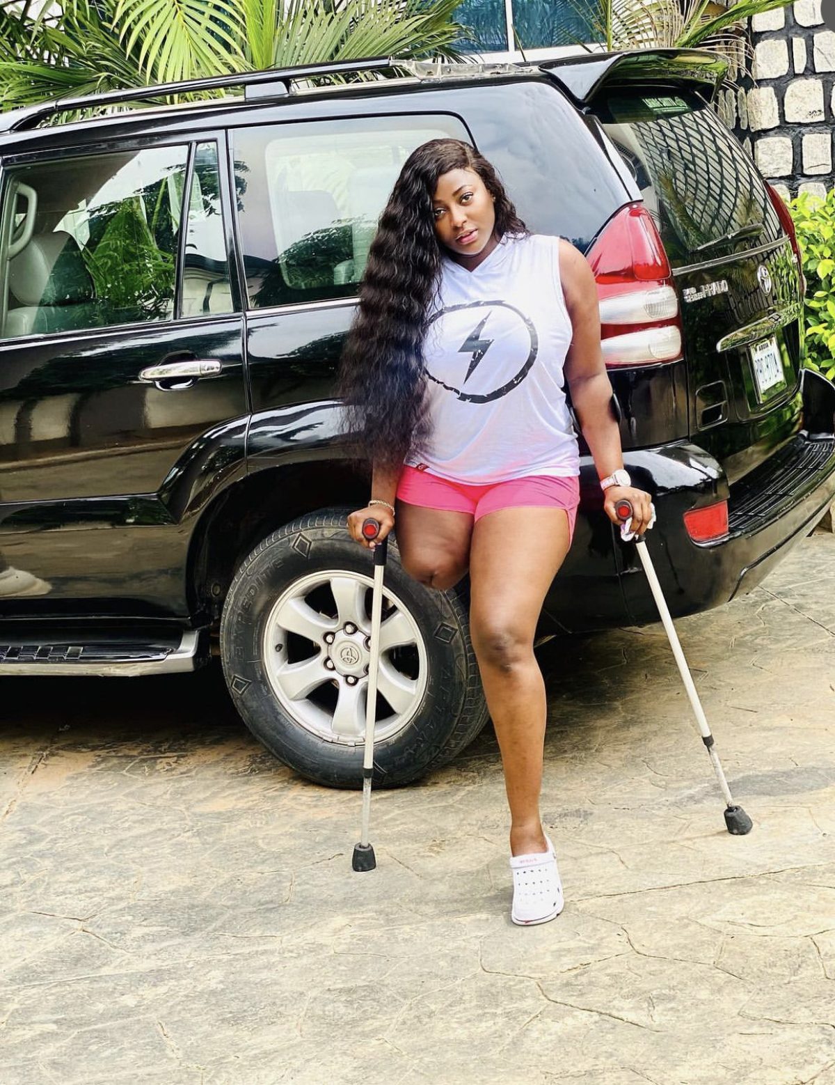 Men date me out of pity – Amputee actress, Doris Akonanya